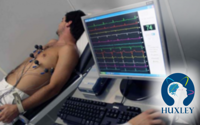ELETROCARDIOGRAMA (ECG)